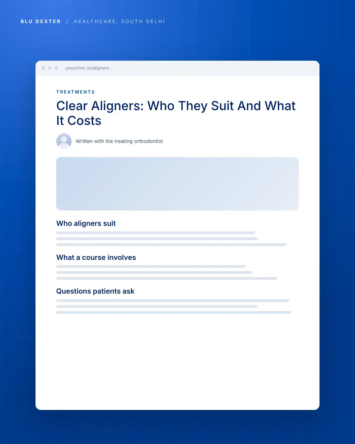 Step 3, Treatment Pages: Treatment page on clear aligners